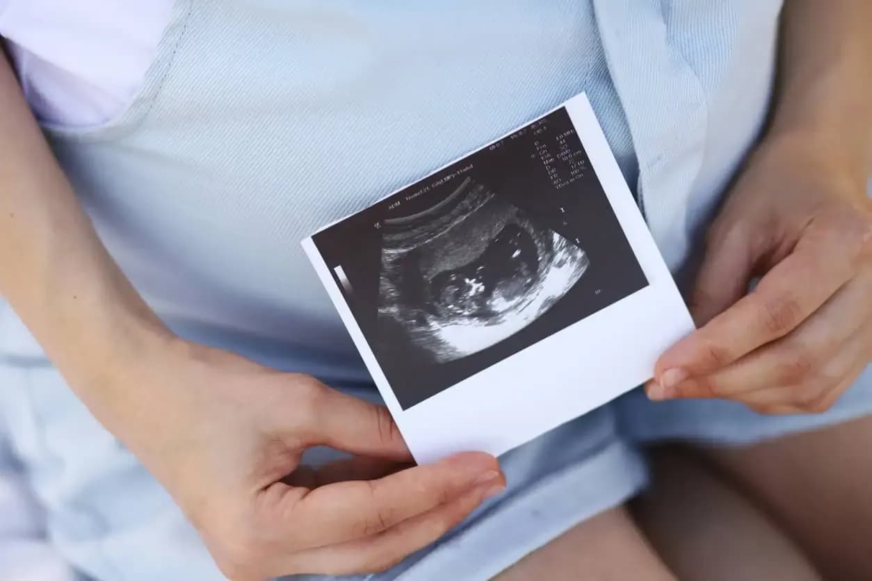 Ustawa o aborcji w Polsce: kluczowe przepisy i kontrowersje